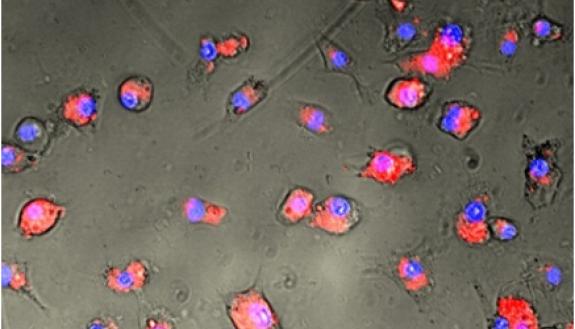 Florescence microscopy image of mouse dendritic cells with mRNA-loaded blood cells