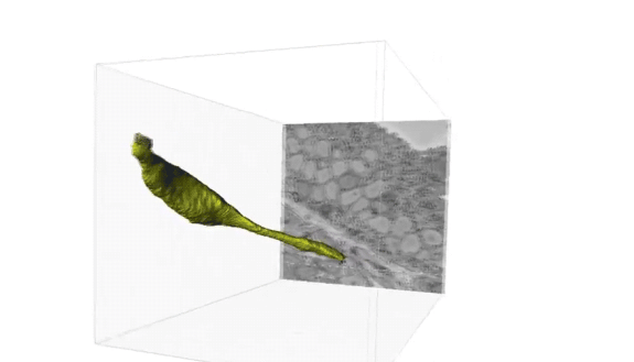 Sensory cells lining the gut are similar to cells on the tongue and in the nose. Now we know, they communicate with the brain.