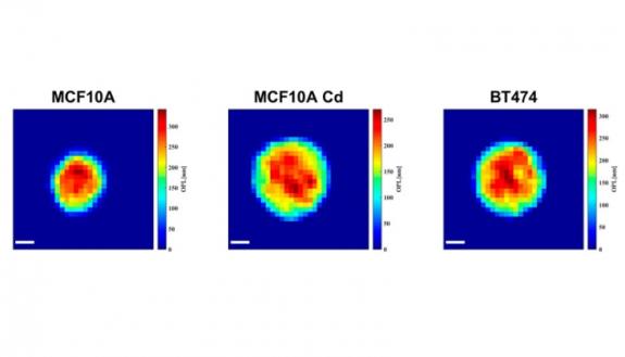 Three single-cell images taken by a new high-speed cell holography device. By measuring physical aspects of a cell, researchers can identify signs of disease. Here, the darker, more red colors indicate a taller cell height while the lighter blue indicate 