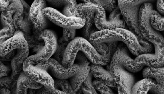 When carbon nanotube forests are placed on an elastomer substrate pre-stretched in two directions, it creates a maze of spaghetti instead of rows, improving the stretchable supercapacitor’s performance