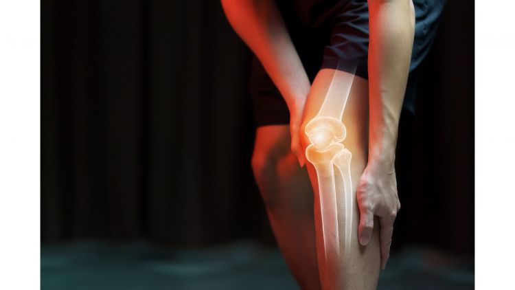 Duke researchers have developed a gel-based cartilage substitute to relieve achy knees that’s even stronger and more durable than the real thing. Clinical trials to start next year. Credit: Canva