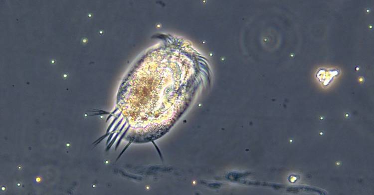 Protists such as this Euplotes are common in water, soil, even moss. Scientists say a few simple measures of a protist’s cell size and shape can be powerful predictors of how they might respond to global warming. Courtesy of Dan Wieczynski. 