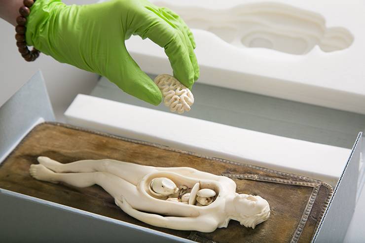 Centuries-old anatomical models get custom enclosures to keep them safe.