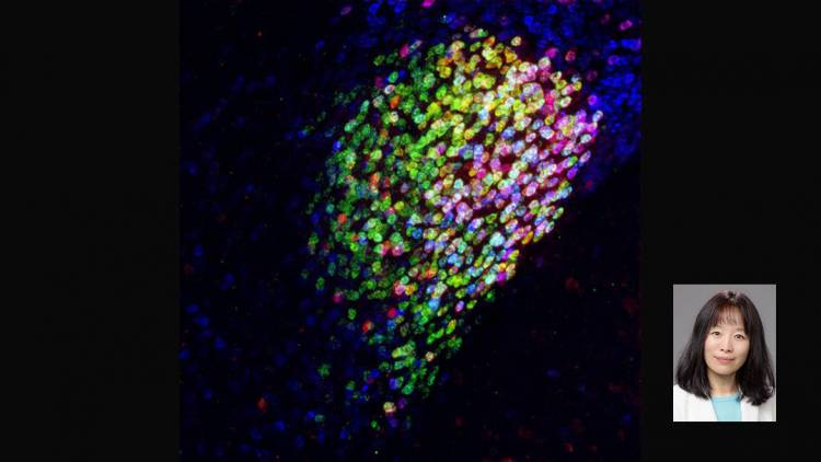 Fan Wang, Neuron cells in the central amygdala of a mouse brain.