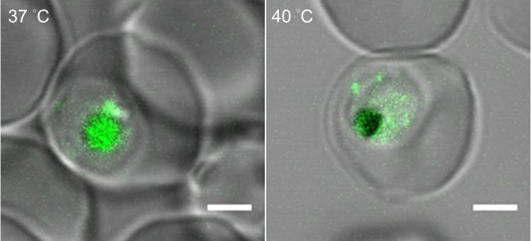 Malaria parasites at normal body temperature (left) and fever-like temperatures (right). A new study finds that the malaria parasite puts body armor around its ‘gut’ to withstand its human host’s raging fevers. Credit: Kuan-Yi Lu, Duke University