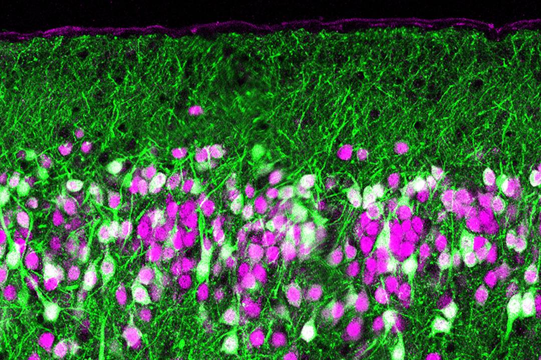 A section of a mouse’s olfactory cortex, where scent signals from the olfactory bulb are processed to help the brain identify odors. Disrupting this processing with a toxin (green) reveals how this processing works. (Kevin Franks lab)