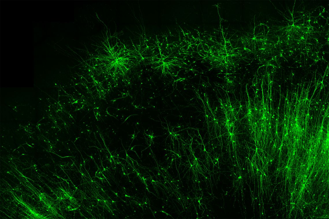 Tagging and illuminating only the inhibitory “brake” cells (green) in human brain tissue is just one of many things the new tool, CellREADR, can do. Credit – Derek Southwell, Duke University