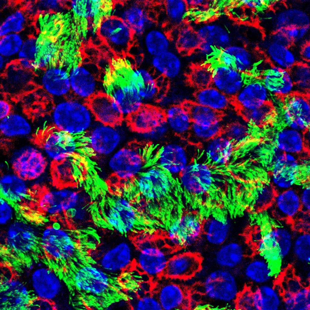 Cells of the upper respiratory tract are where influenza virus infection occurs. Red marks basal cells, green marks ciliated cells, and blue marks cell nuclei. Photo credit:  Rebekah Dumm, Duke University