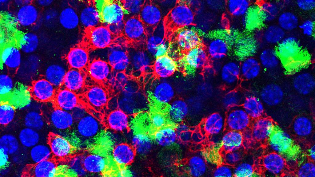 Duke researchers are studying one kind of lung cell that ramps up its DNA repair mechanisms to resist being killed by influenza. (Ciliated cells are green, basal cells are red, and cell nuclei are blue). (Nicholas Heaton Lab)