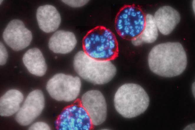 A microscope image of the Plasmodium parasite inside liver cells