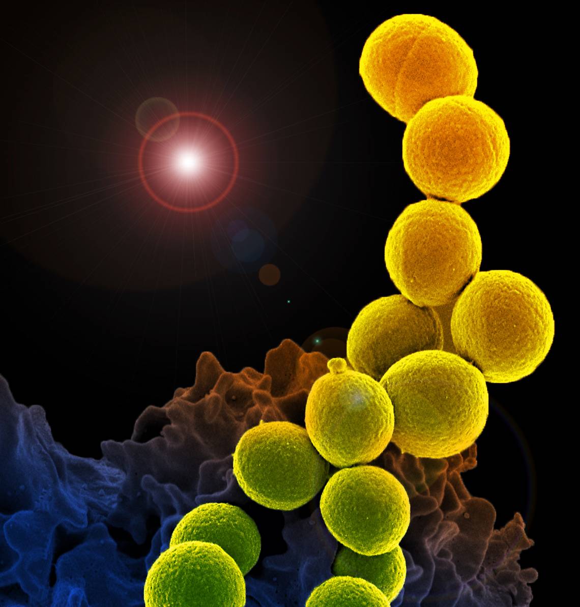 In this image, bacteria (yellow) interact with a human white blood cell. If left unchecked, this encounter might develop into the runaway immune response to infection called sepsis. Credit: NIH-NIAID