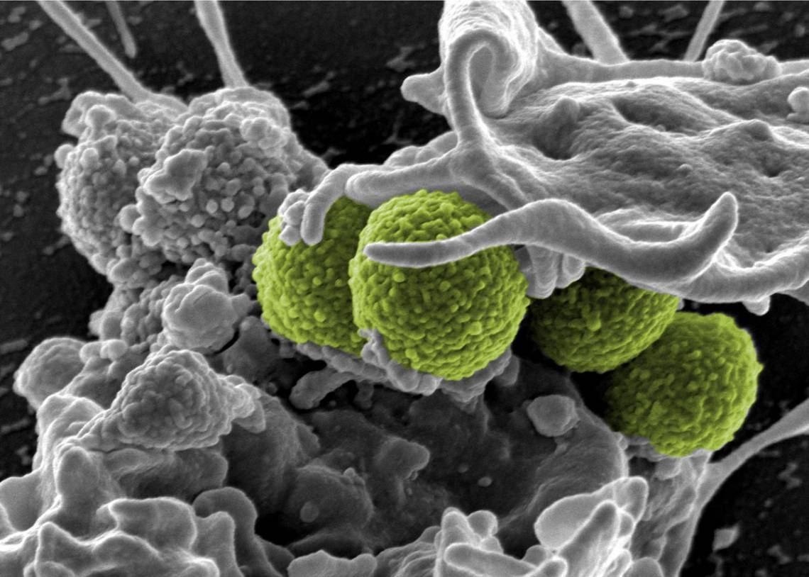 A new study models better diagnostic tests that could help turn the tables on drug-resistant bacteria, like this hospital-associated MRSA (green). (NIAID) 