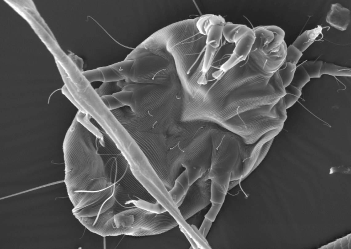 Only about two dozen of the thousands of proteins making up a dust mite actually trigger allergic reactions. A new technique shows that these sniffle-making proteins share a combination of stability and abundance. Credit: Holly Leddy, Duke University 