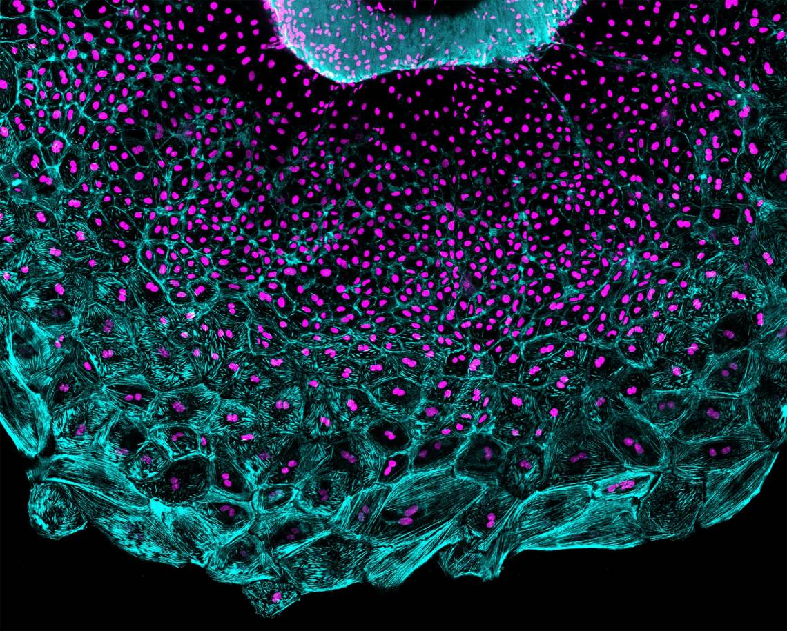 Cells covering the heart regenerate in a wave led by large cells containing multiple nuclei per cell (magenta). These cells are under more mechanical tension (aqua streaks) than trailing cells which divide to produce cells with one nucleus each.