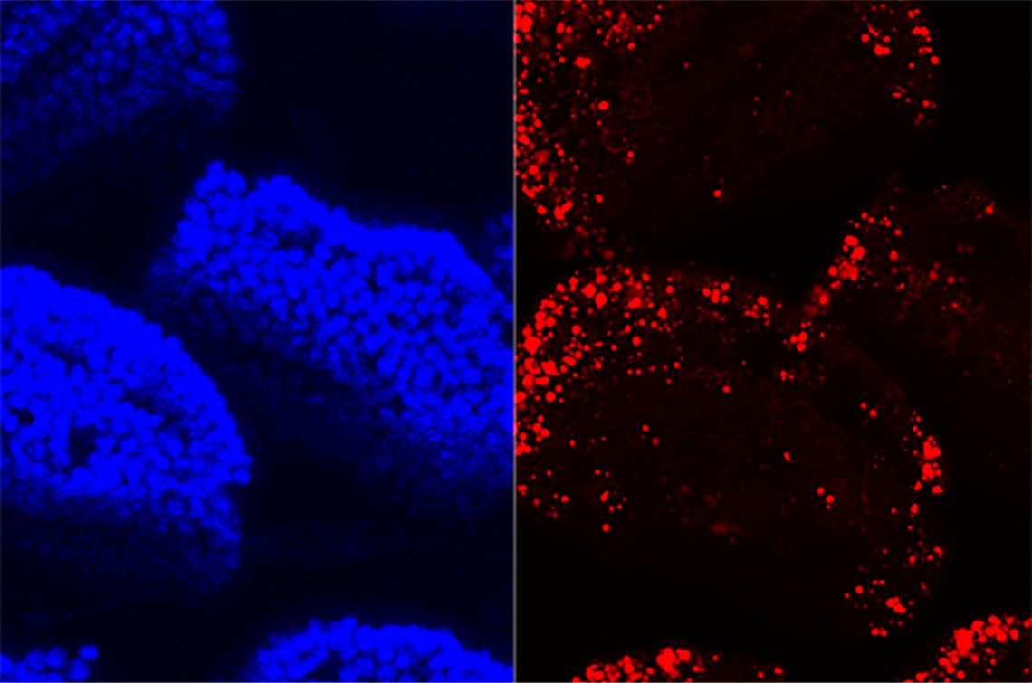 A confocal microscopy image of villi in the small intestine shows cell nuclei in blue and absorbed dietary fat in red. (John Rawls Lab)