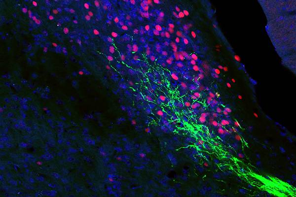 Green string-like neurons extend into a sea of pink dots