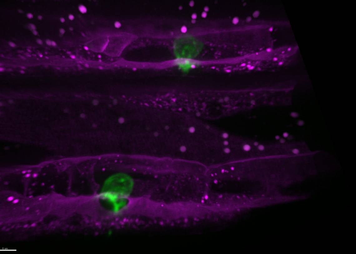Magnified hundreds of times, these green cells in C. elegans worms can change their tactics to get around once-promising cancer drugs and trespass into other tissues. The findings may point to better ways to block cancer’s spread. Laura Kelley, Duke Univ.