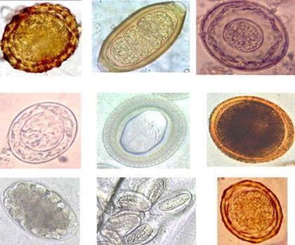 Through a microscope they may look like mere round specks in a sample of stool, but each of these specks is an egg from an intestinal worm. Photo credit: Photo collage by Catalina Maya Rendón via Wikimedia Commons.