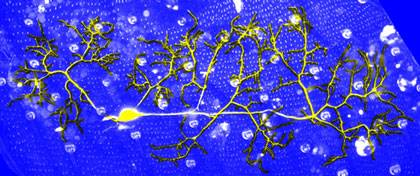 An artist's conception of dendrites regenerated from a fly sensory neuron after undergoing developmental pruning. (Chay Kuo Lab, Duke University)