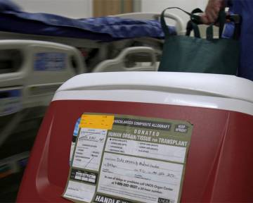 Duke’s Liver Transplant Program Shows Best-in-Nation Results
