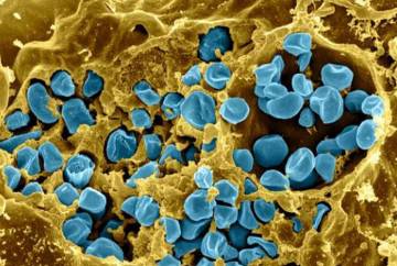 This scanning electron micrograph shows a mouse immune cell (yellow) infected with Francisella tularensis bacteria (blue). Credit: National Institute of Allergy and Infectious Disease.
