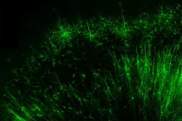 Tagging and illuminating only the inhibitory “brake” cells (green) in human brain tissue is just one of many things the new tool, CellREADR, can do. Credit – Derek Southwell, Duke University