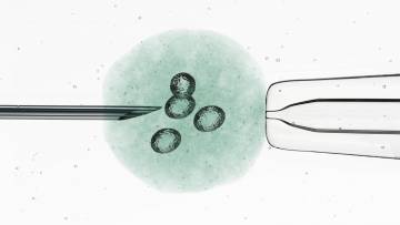 Photo showing needle inserting eggs through the IVF procedure