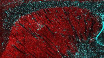 A cross-section of the striatum in a mouse brain. Loss of huntingtin protein in striatal neurons (red) causes neuron loss and an inflammatory response, shown by the infiltration of glial astrocytes (cyan). (Caley Burrus, Duke)